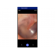 Image de l'intérieur d'une oreille vue avec l'otoscope Macroview